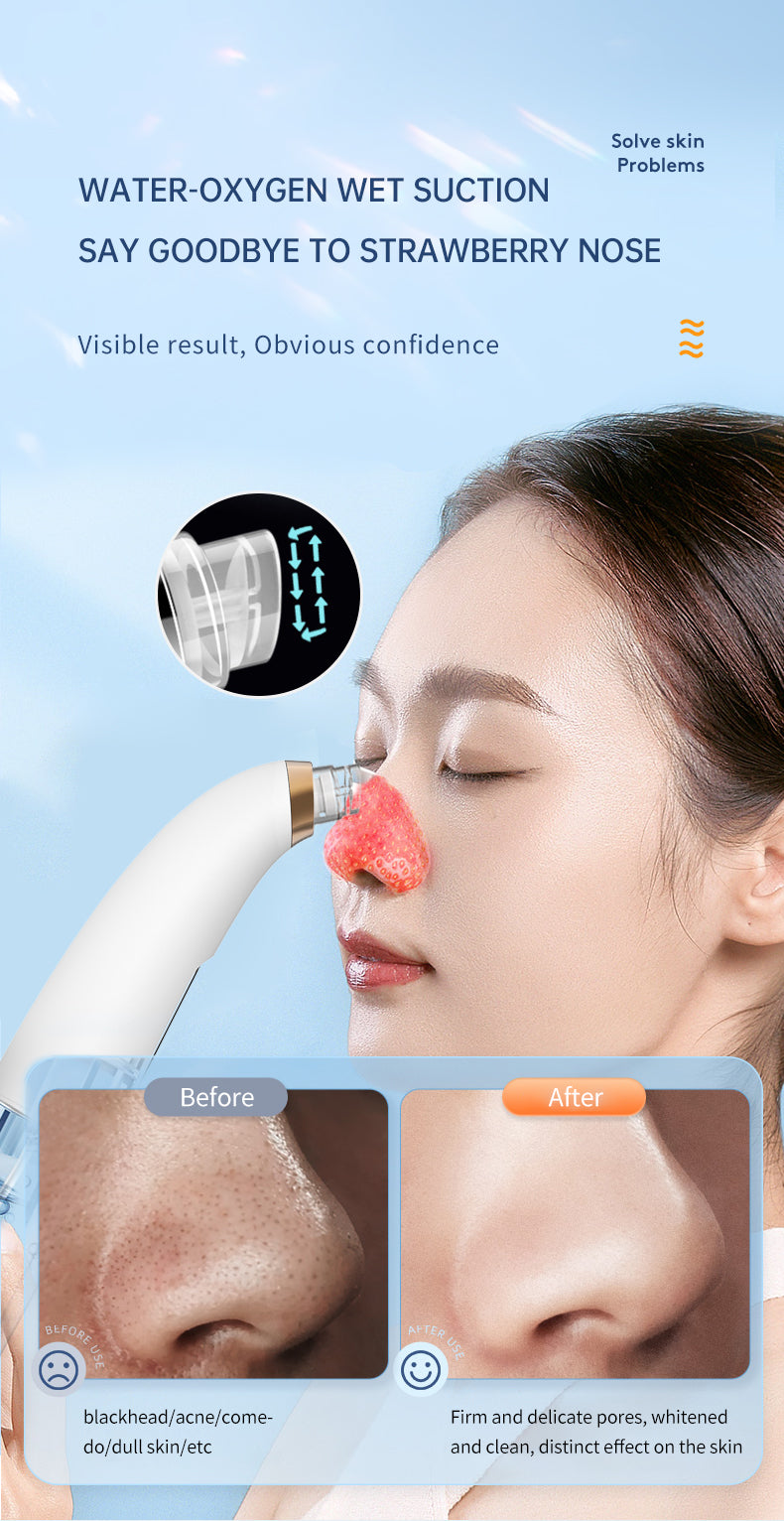 Blackhead remover and hydro facial device